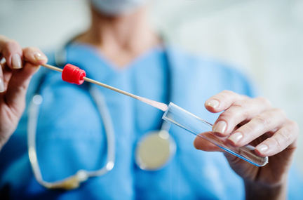 Método de fabricação de swab de amostragem de flocagem médica